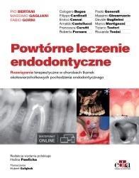 POWTÓRNE LECZENIE ENDODONTYCZNE